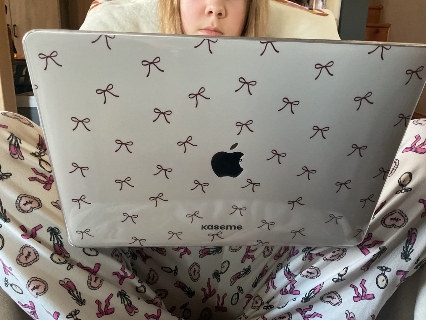 Customer photo review of Roselyn MacBook Skin