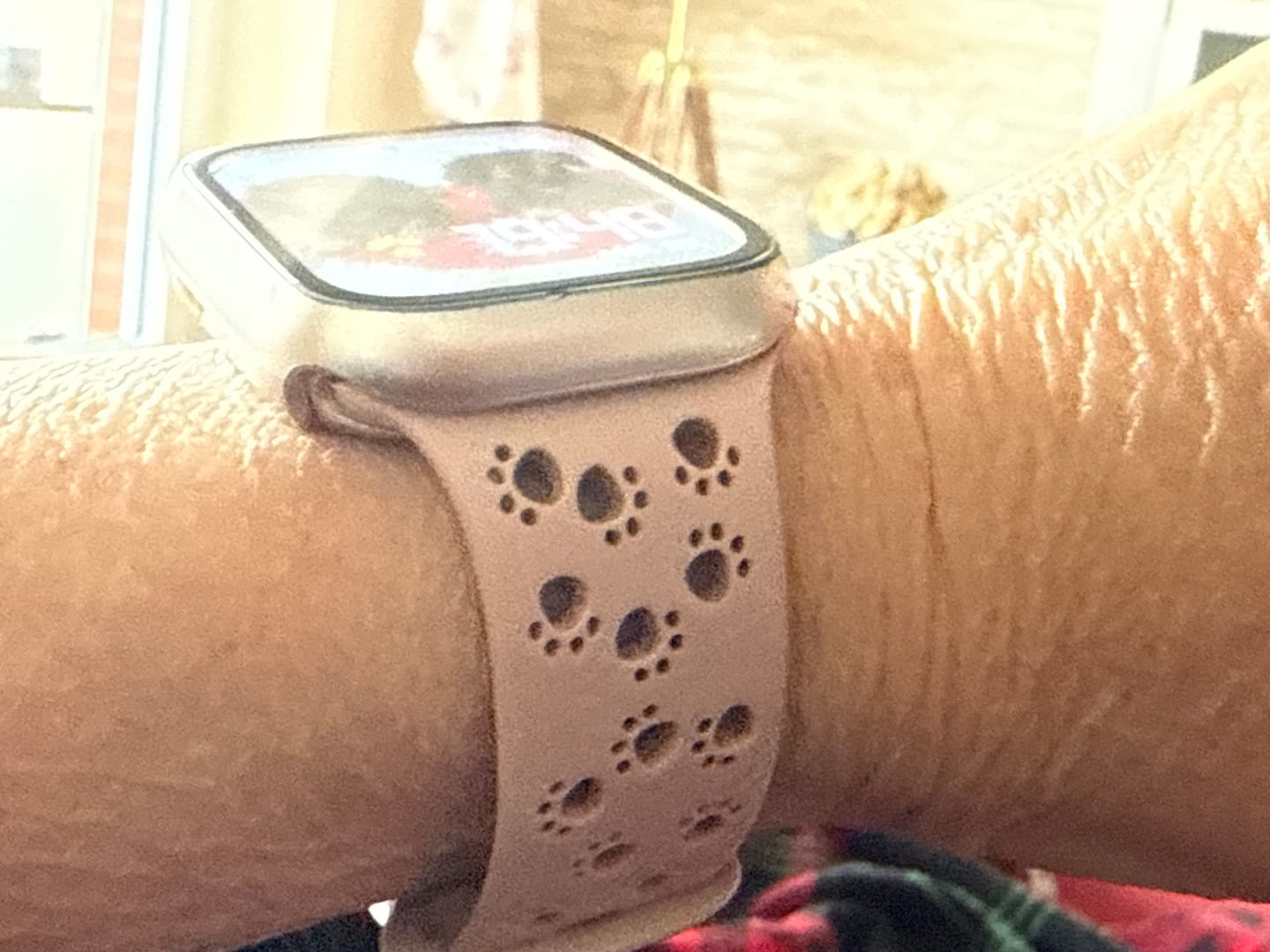 Customer photo review of Apple Watch Silikonband "Pfoten"
