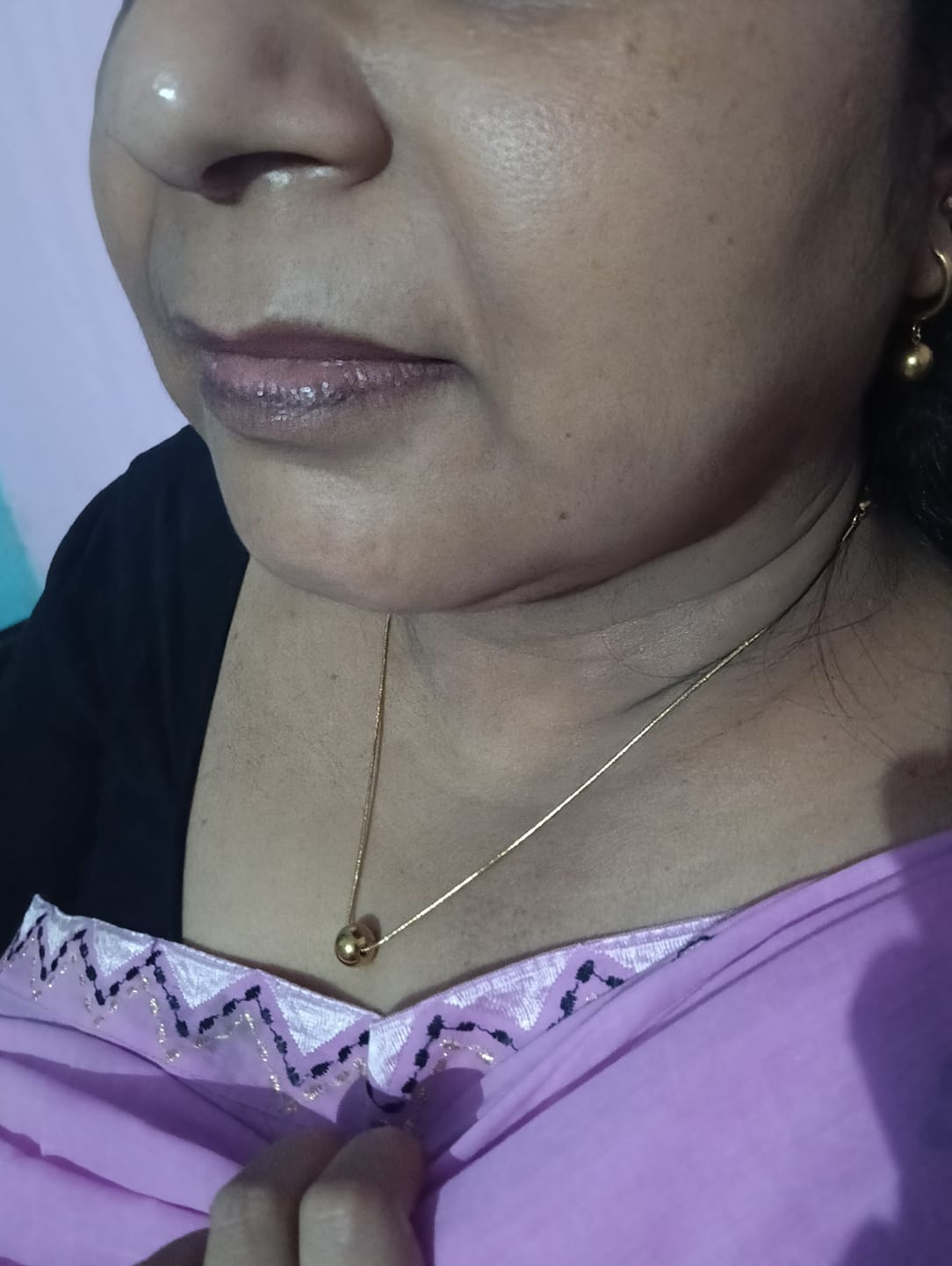 Customer photo review of Golden Orb Set