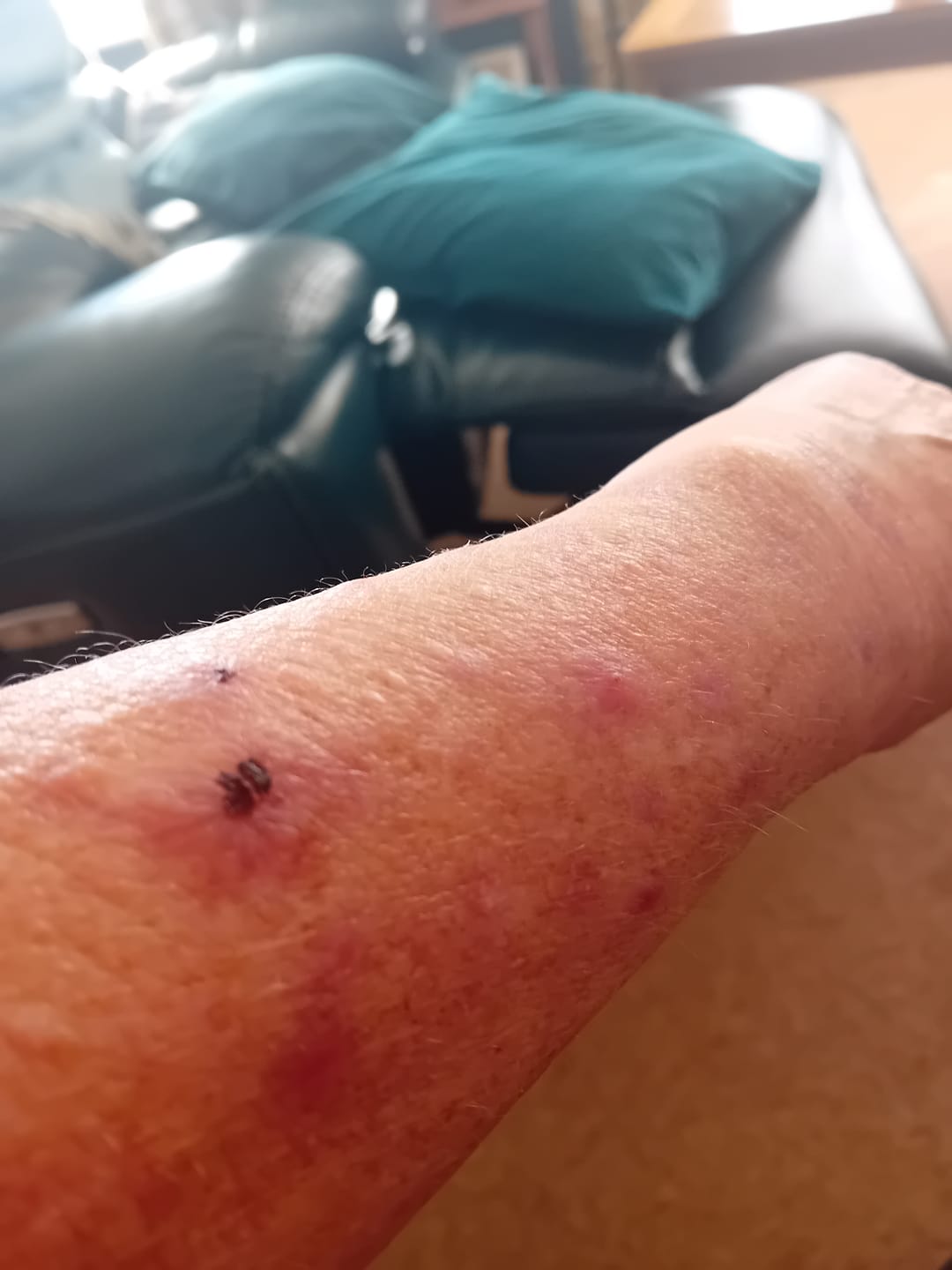 Customer photo review of Bioskin Zeoderm Skin Repair Moisturiser