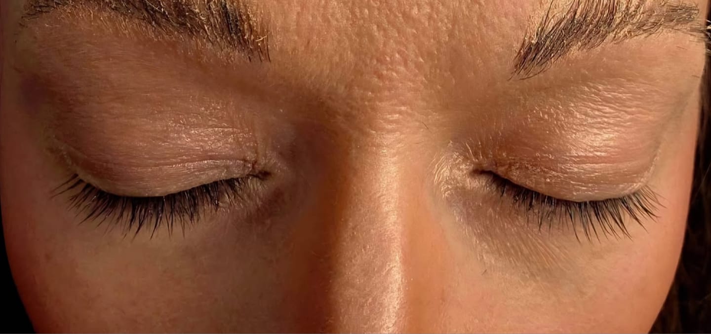 Customer photo review of Wimpernserum