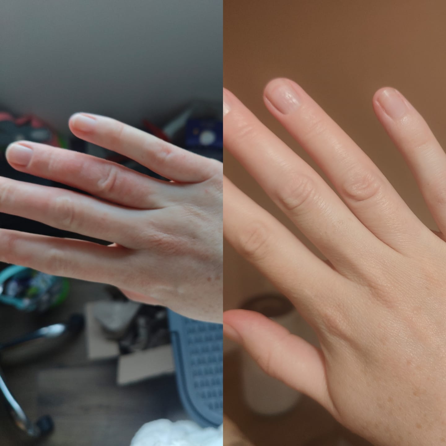 Customer photo review of Large Bioskin Duo Pack
