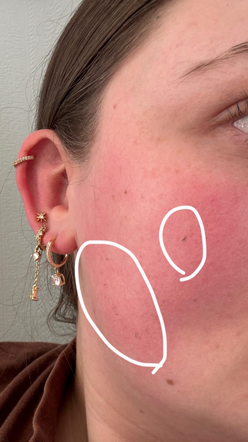 Customer photo review of TORRIDEN DIVE-IN Sun Serum SPF 50+
