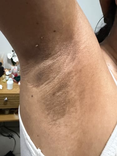 Customer photo review of Bright Skin Bish