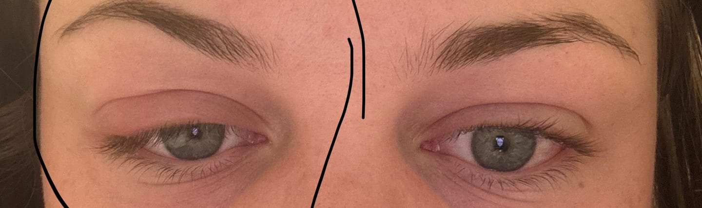 Customer photo review of BROWCOCA!NE - Augenbrauenserum