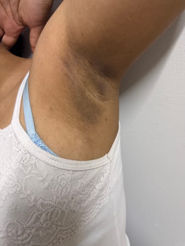 Customer photo review of Bright Skin Bish