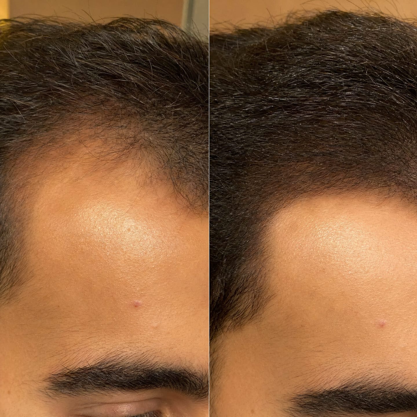 Customer photo review of RootFix - ערכה לטיפול בנשירה והתקרחות של השיער