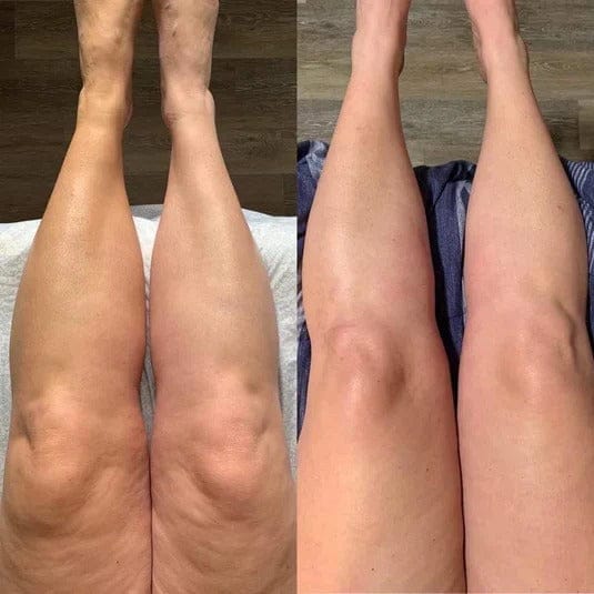 Customer photo review of Cellura™- Feszesítő Szépségroller