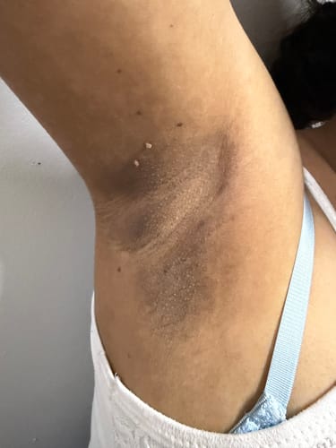 Customer photo review of Bright Skin Bish