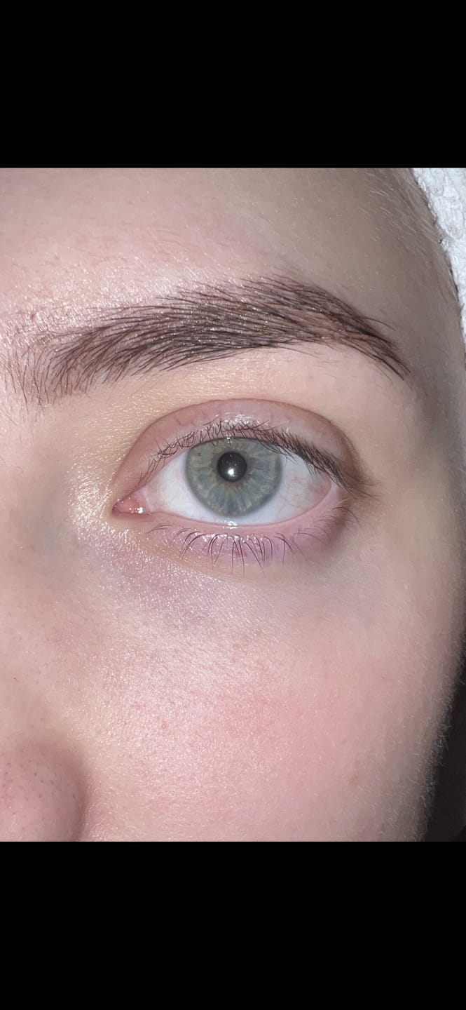 Customer photo review of Lash Serum | INTENSE