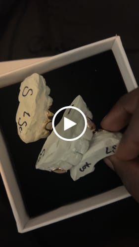 Customer video review of PYRO (GOLD GRILLZ)
