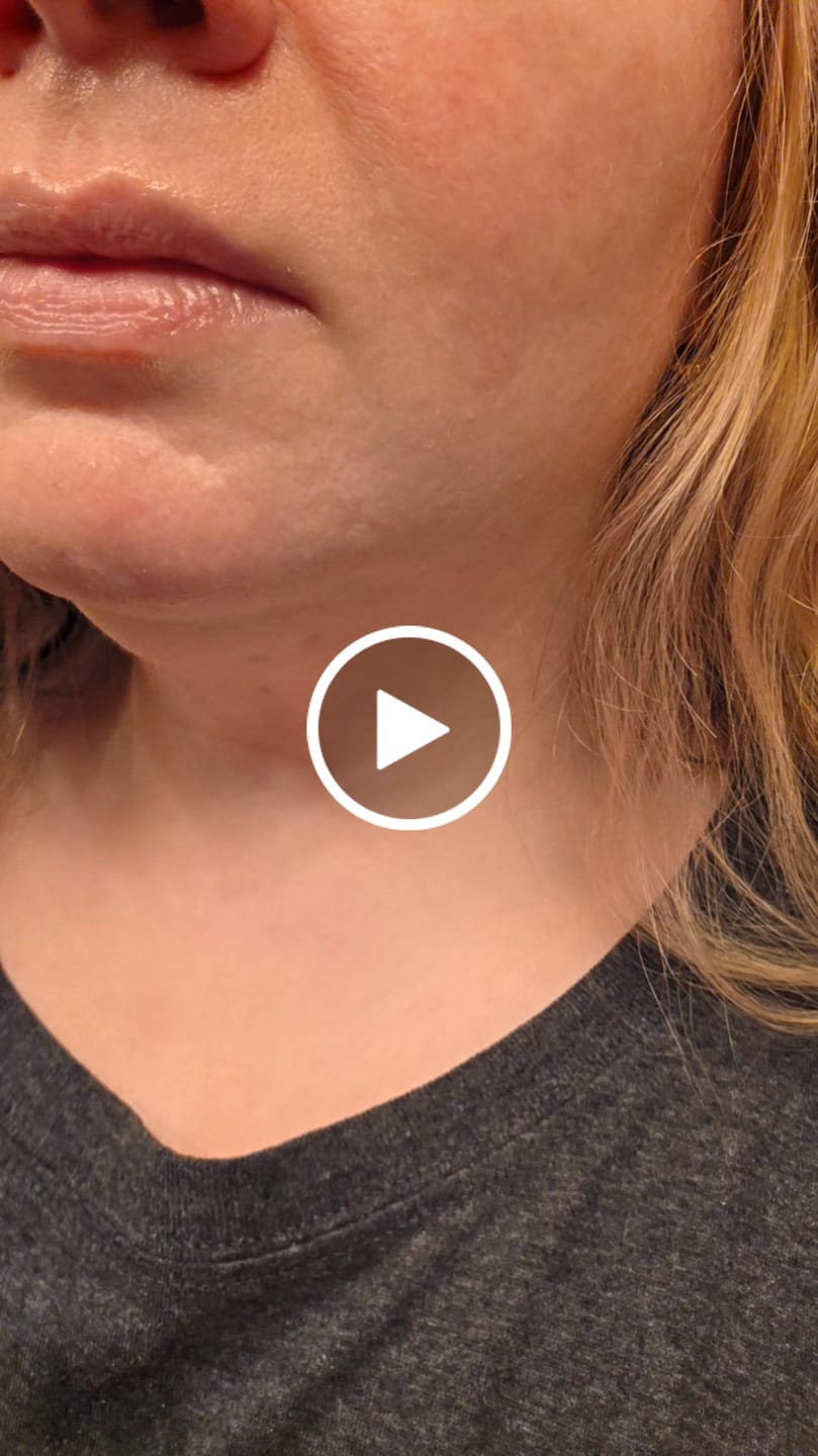 Customer video review of EGF Blue Youth Activating Drop