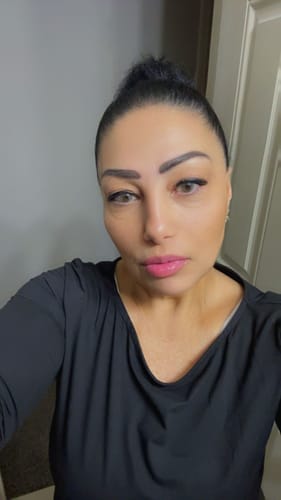Customer photo review of Meetone Hidrotone Oyster Contact Lenses
