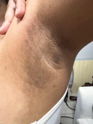 Customer photo review of Bright Skin Bish
