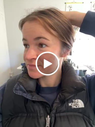 Customer video review of Intermediate Acne Program™