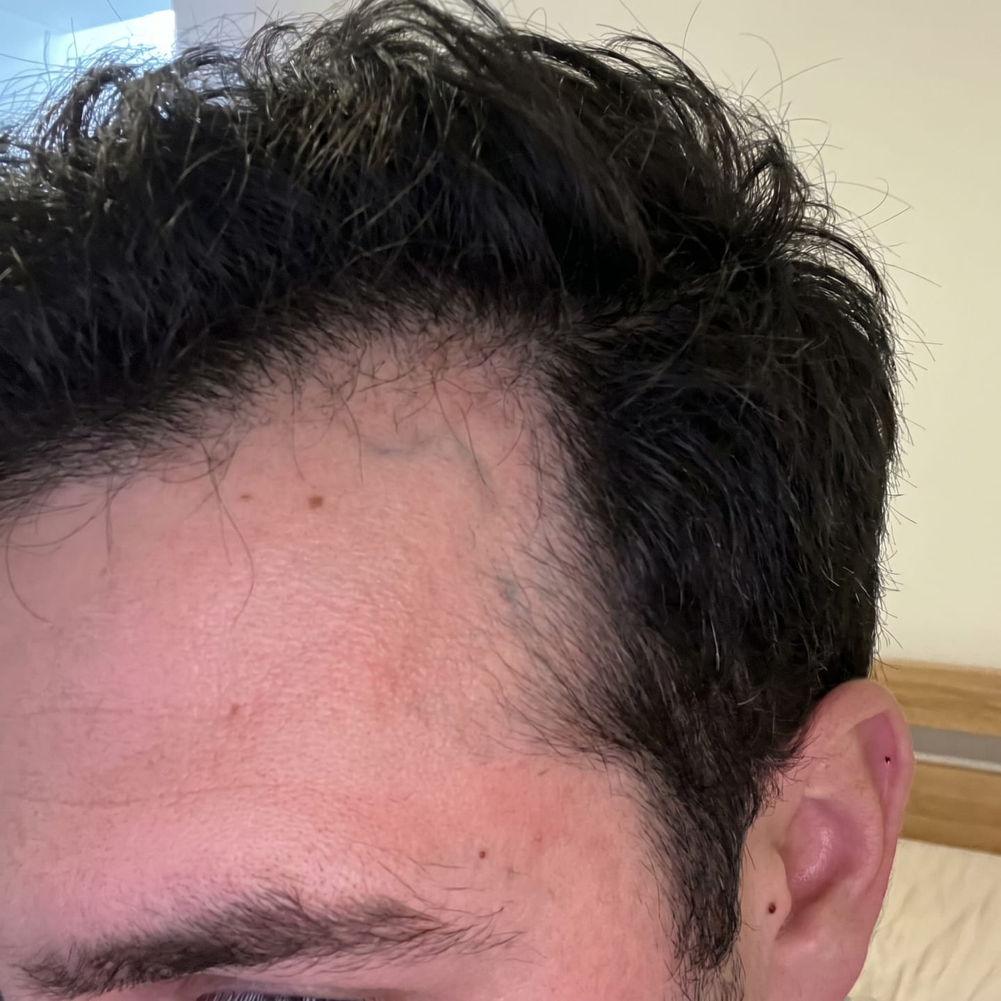 Customer photo review of RootFix - ערכה לטיפול בנשירה והתקרחות של השיער