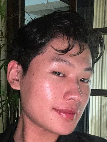 Customer photo review of AZELAIC ACID 10 HYALURON REDNESS SOOTHING SERUM