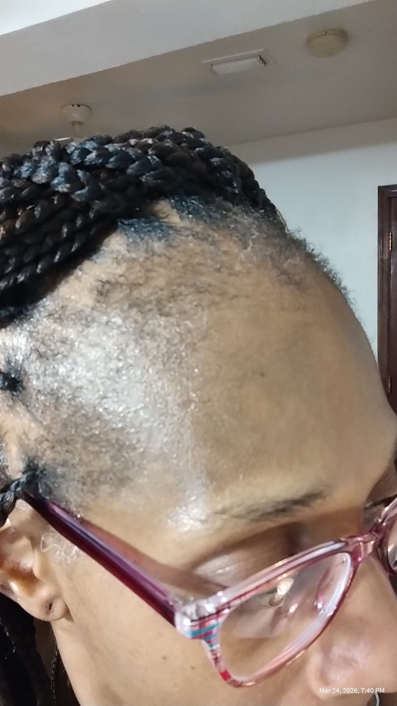 Customer photo review of ⚡Gro & Glow Liquid Vitamins ⚡ WIPEOUT WEDNESDAY
