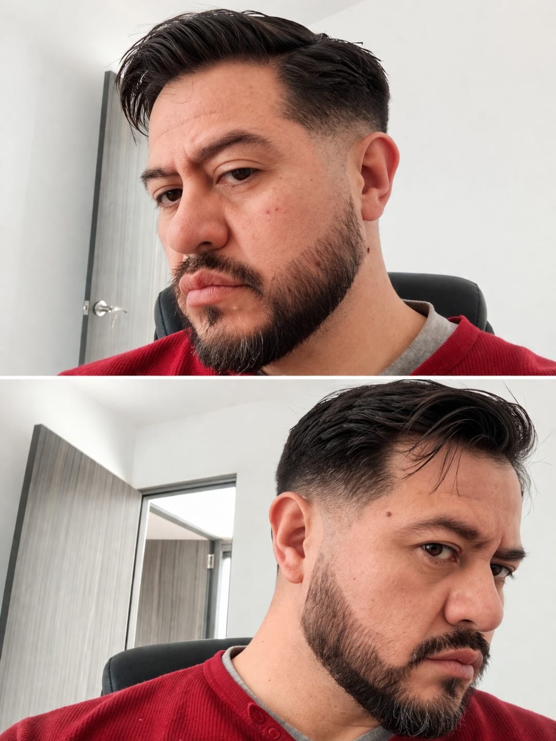 Customer photo review of Kit Barba Real | 2 Minoxidil al 20% +Biotina + Derma | El kit más Completo para crecimiento de Barba