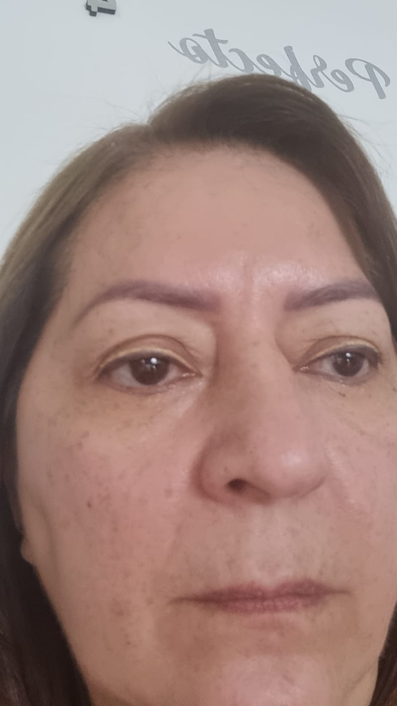 Customer photo review of Tónico Iluminador Aclarante