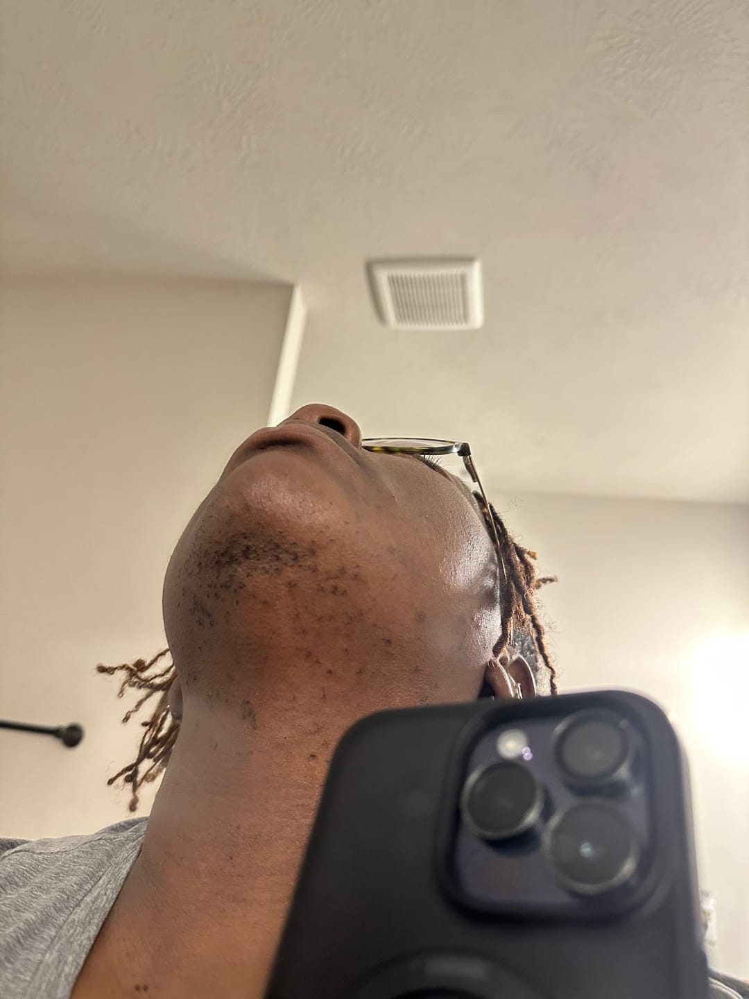 Customer photo review of Hair Reducing Fade Oil - Slows Growth, Thins, and Reduces Hair Naturally