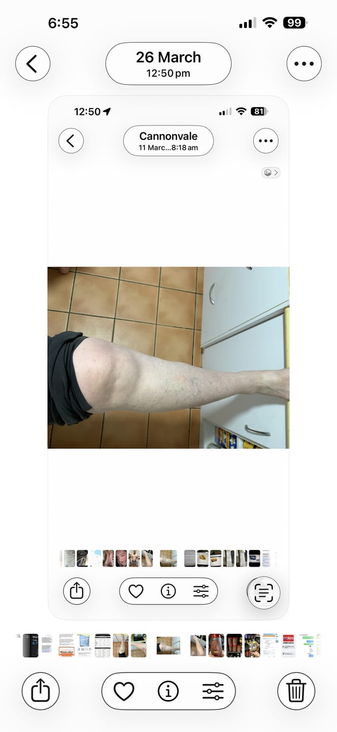 Customer photo review of Self Tanning | 150 Capsules