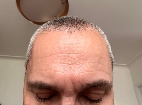 Customer photo review of Seb Natural Calming Serum