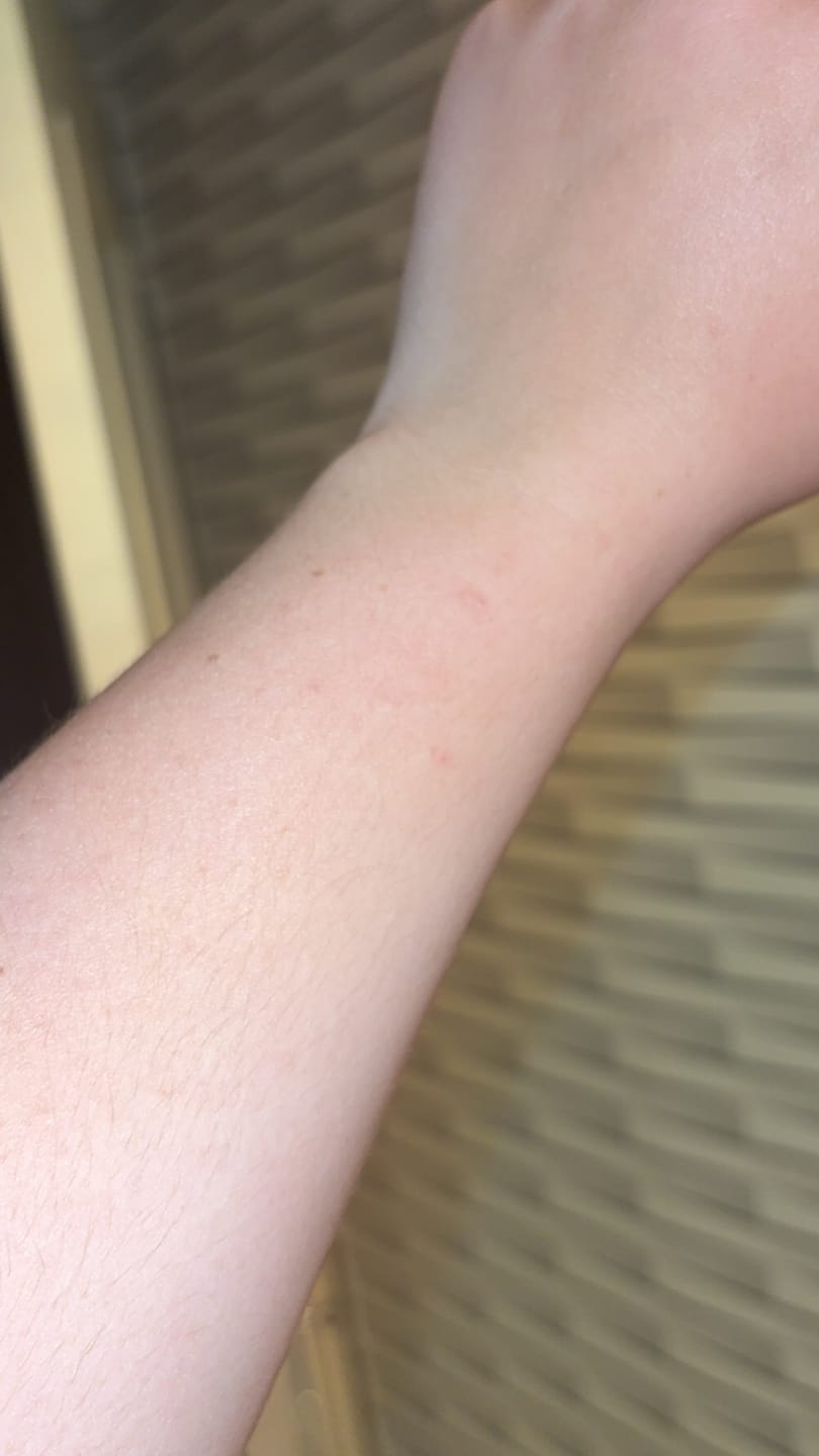 Customer photo review of Good Sun Auto-bronzant - 1 mois