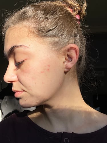 Customer photo review of Super Glaze