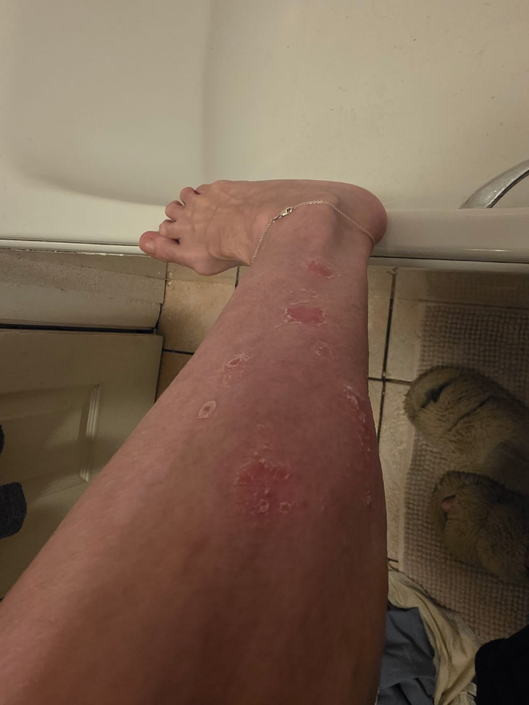 Customer photo review of Multi Strain Biotic
