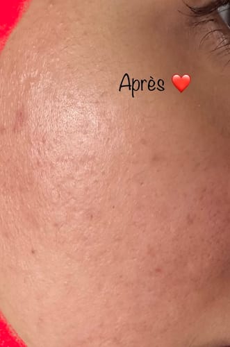 Customer photo review of CLARIFYING SERUM