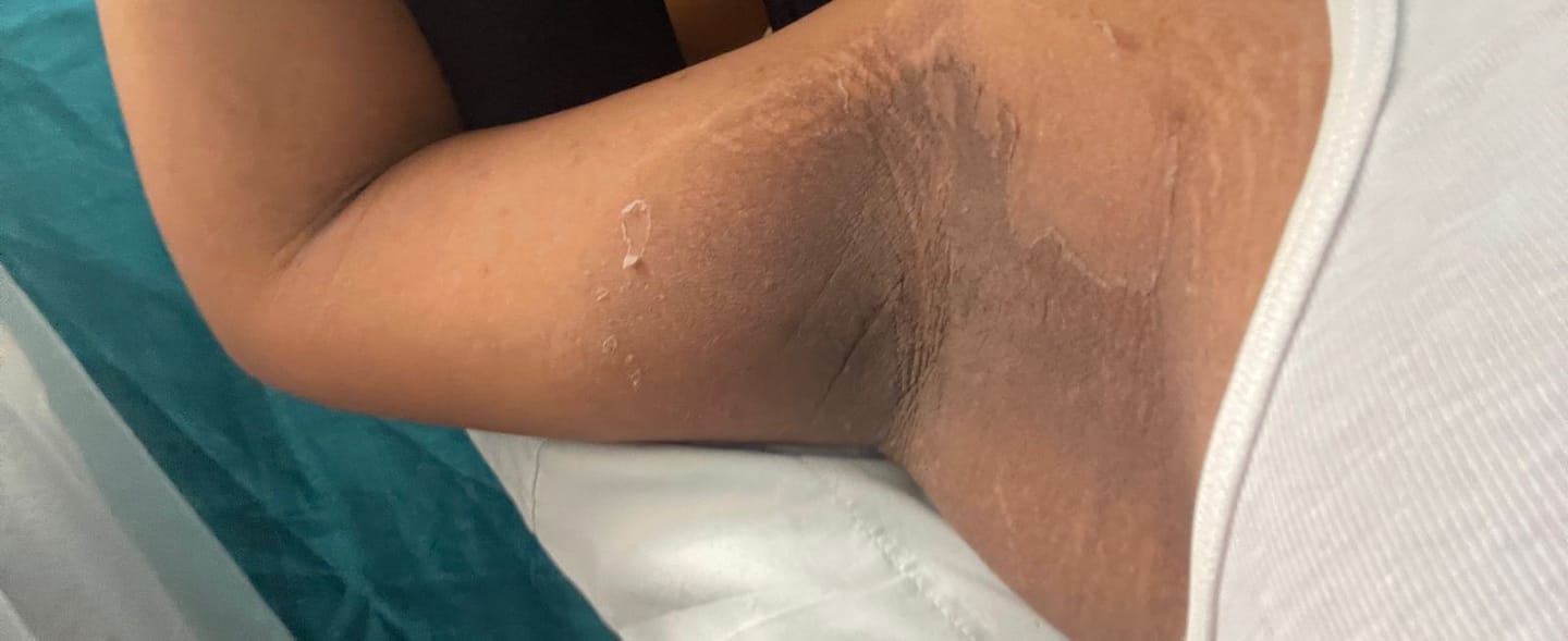 Customer photo review of Zena 100% Organic Algae Peel