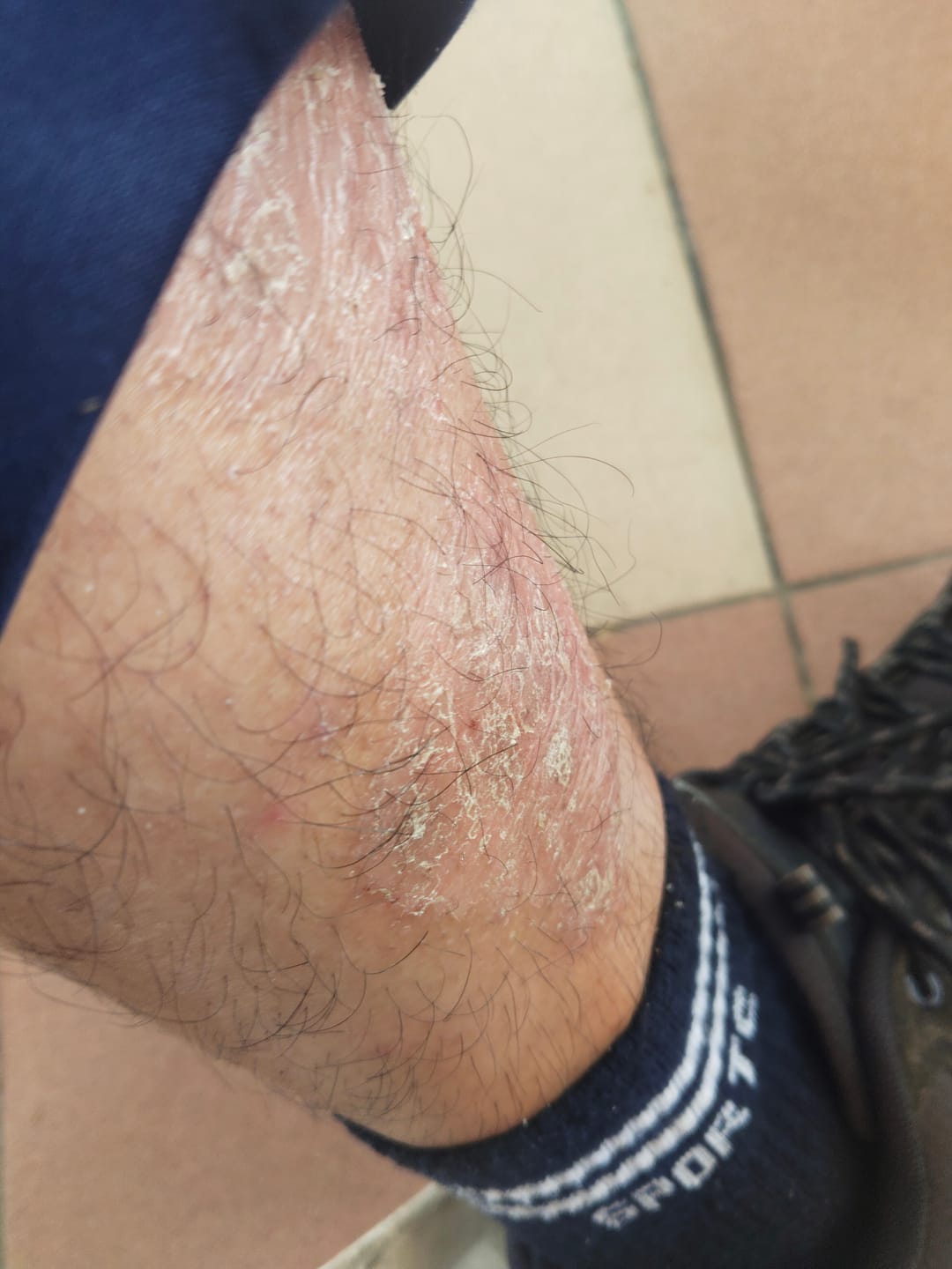 Customer photo review of Jolicare Cream