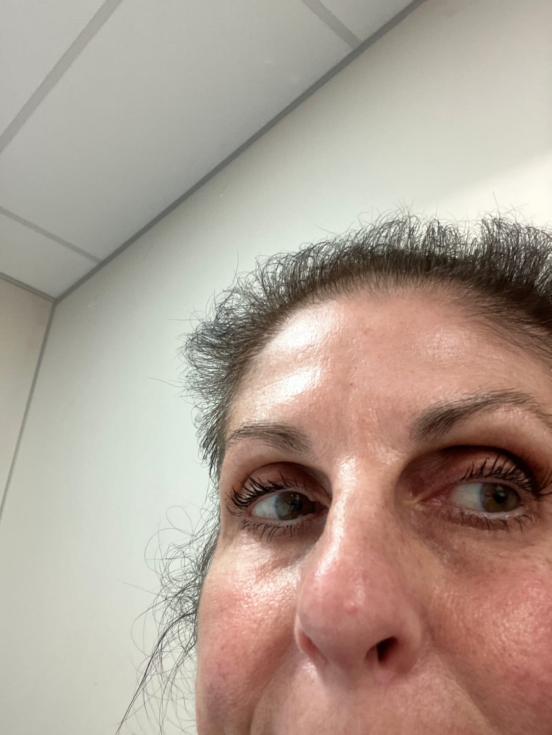 Customer photo review of Enhance® - Eyelash Growth Serum