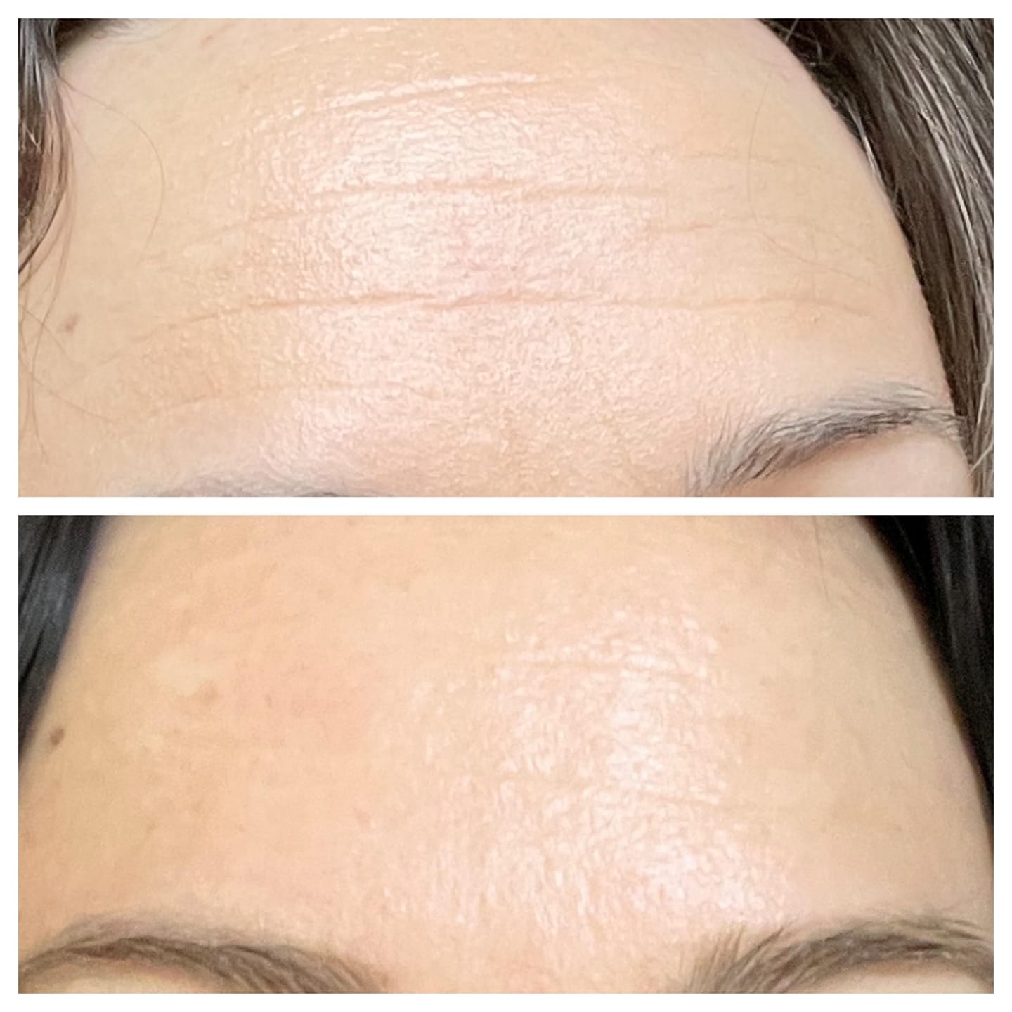 Customer photo review of Retinol Supreme Elixir