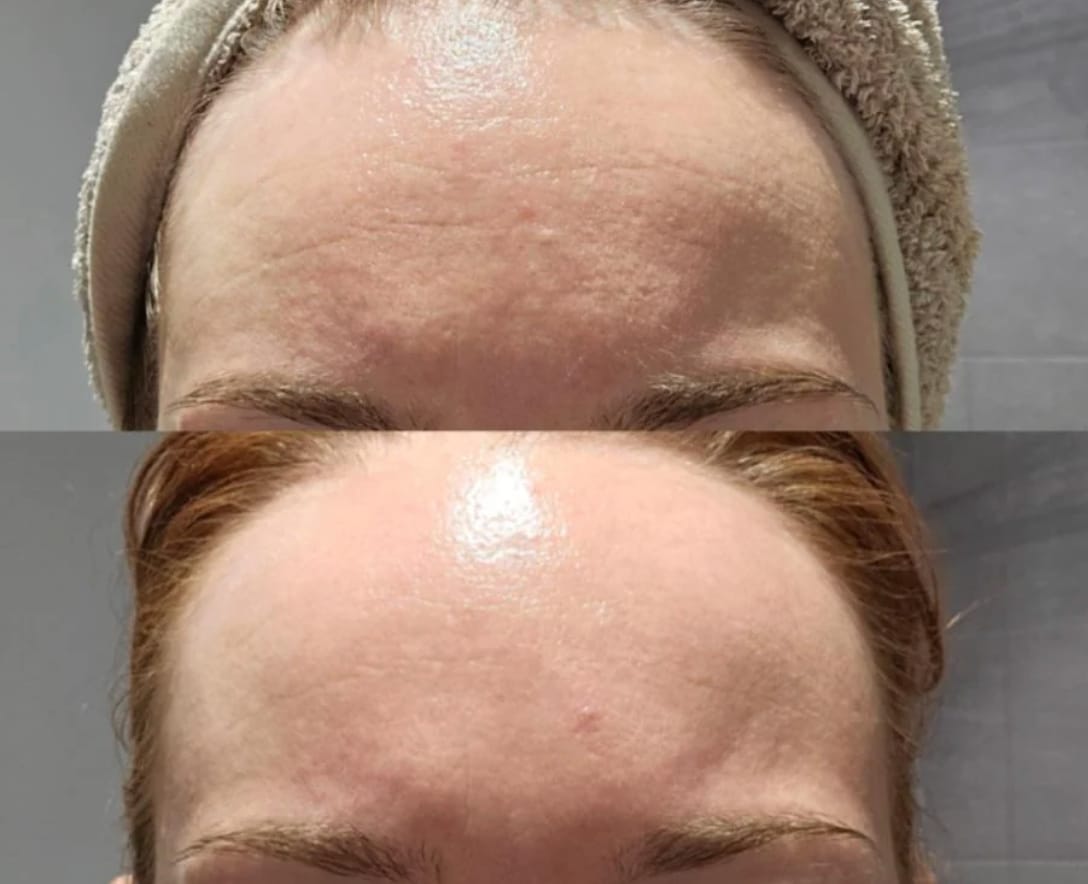 Customer photo review of Retinol Supreme Elixir