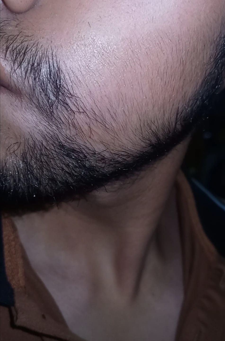 Customer photo review of Minoxidil al 13 % | Tónico para Crecimiento de Barba. Fórmula Original