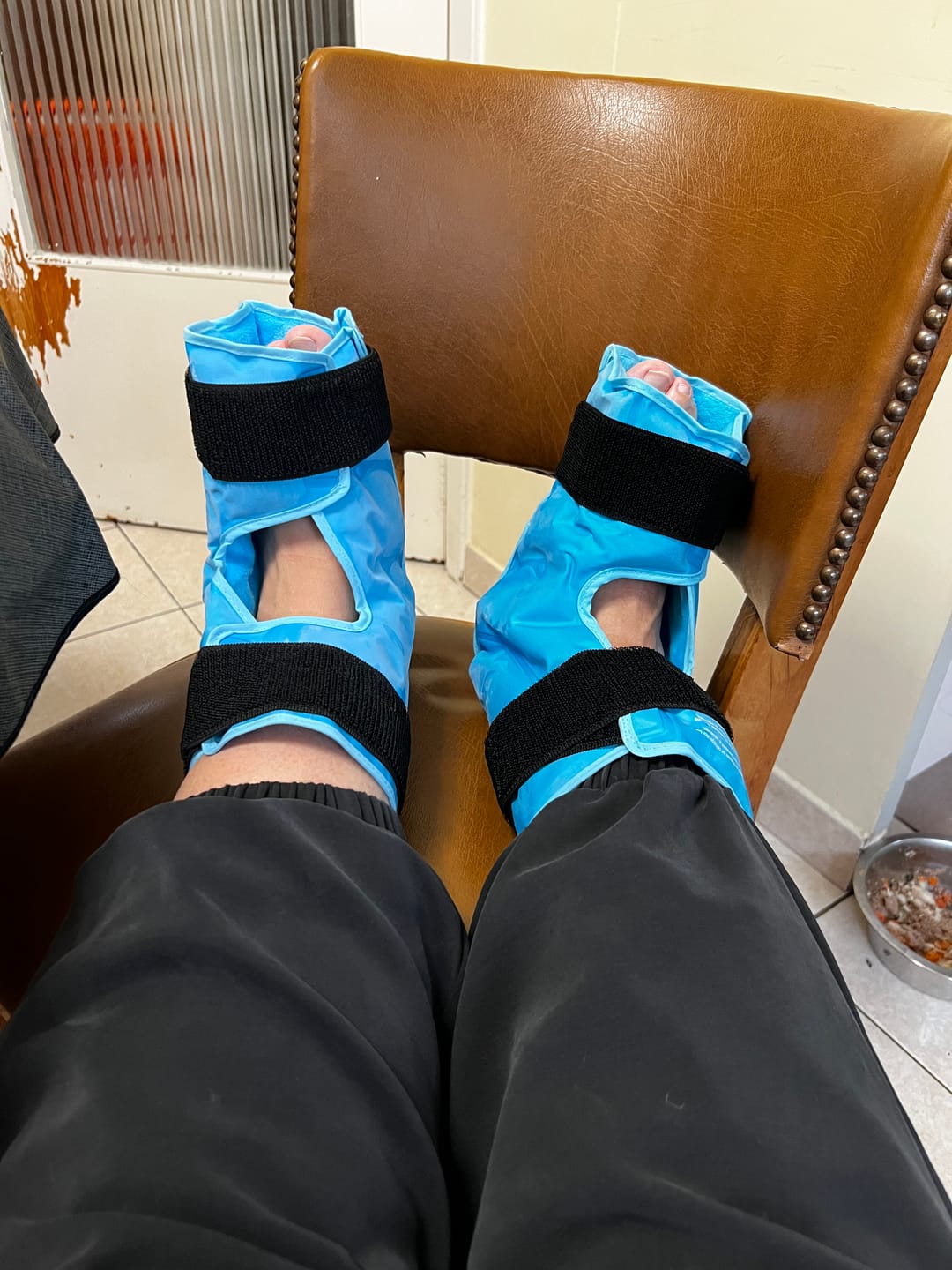 Customer photo review of Icepack voor Voet & Enkel – Gerichte Koudetherapie