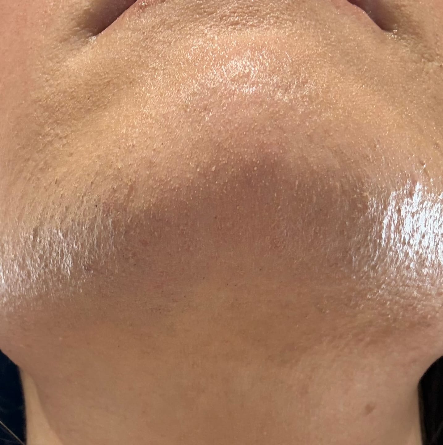 Customer photo review of Unwanted Hair & Skin Balance Bundle