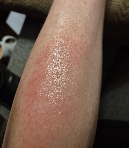 Customer photo review of Seb Natural Soothing Balm