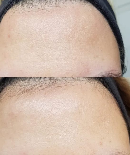 Customer photo review of Retinol Supreme Elixir