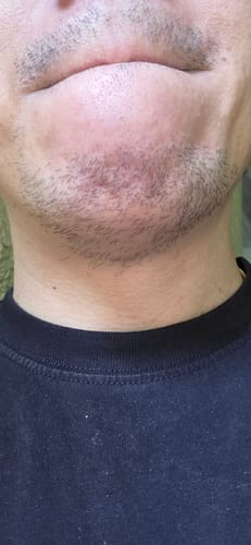Customer photo review of Seb Natural Calming Serum
