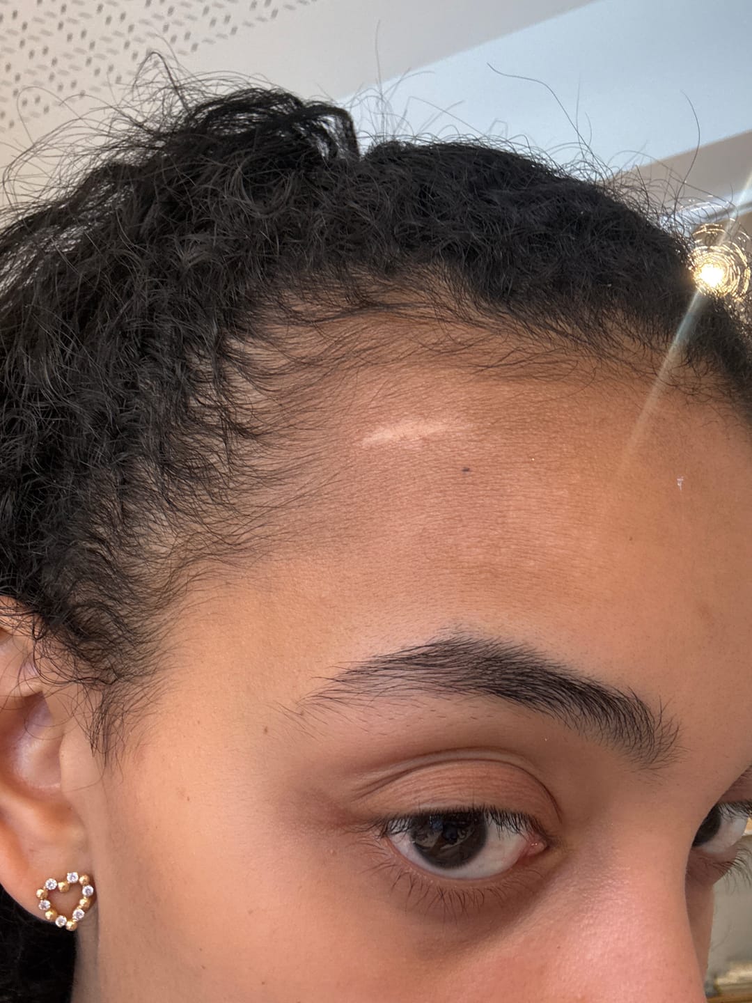 Customer photo review of VITAFOAM ™ Hair Growth Formula