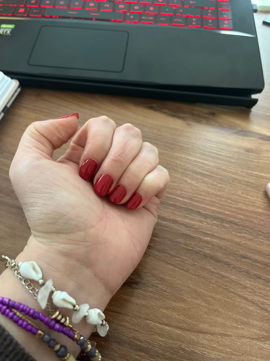 Customer photo review of Başlangıç Seti | Jel Lambası Hediyeli