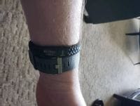 Customer photo review of Medizinisches Notfallarmband