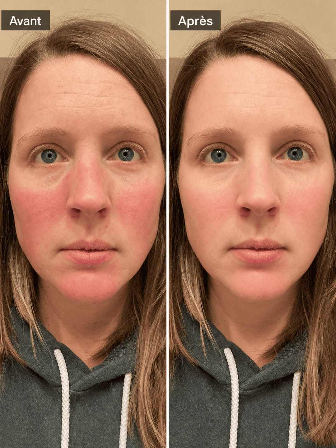 Customer photo review of Sérénova — Formule Anti-Cortisol Bien-être & Équilibre