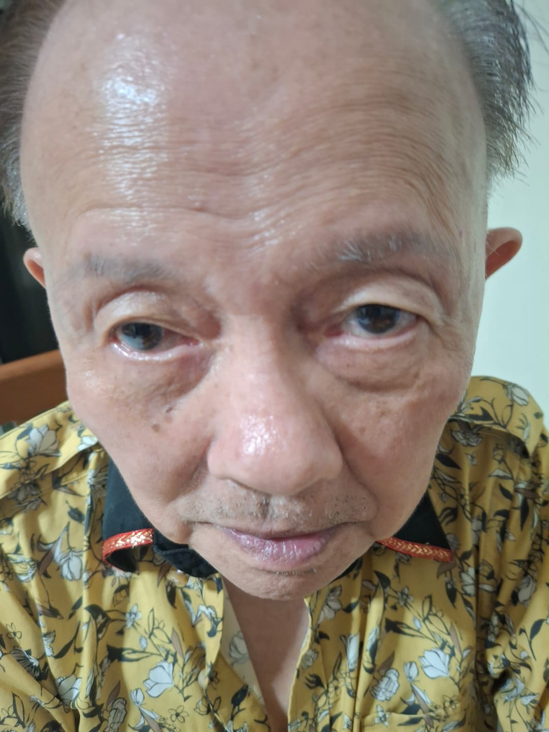 Customer photo review of Jolicare Cream
