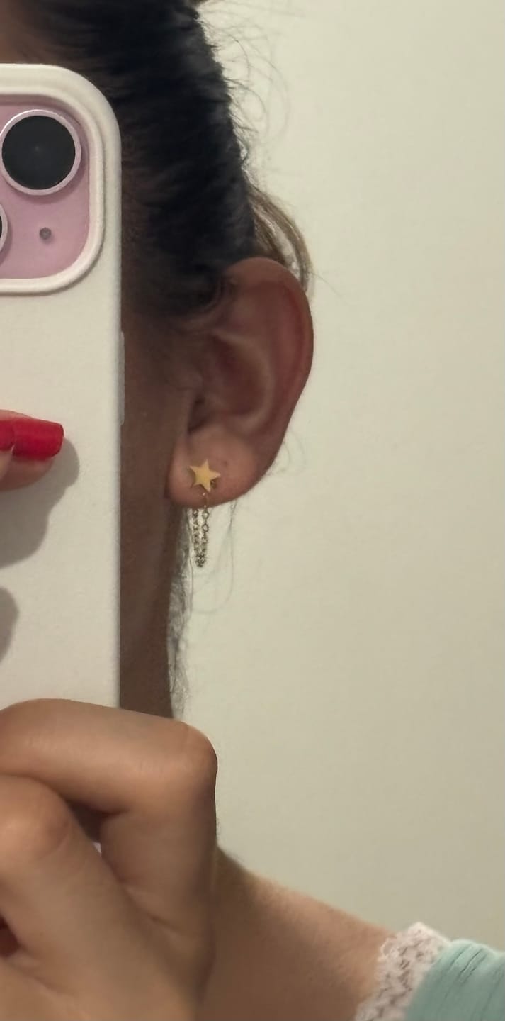 Customer photo review of Arete Estrella
