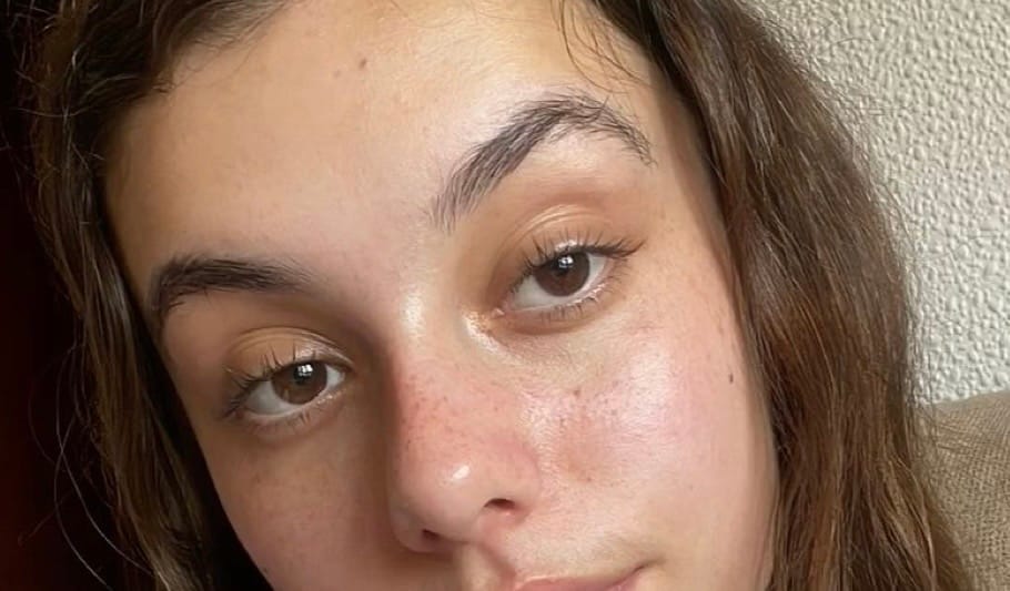 Customer photo review of Black Lash Serum