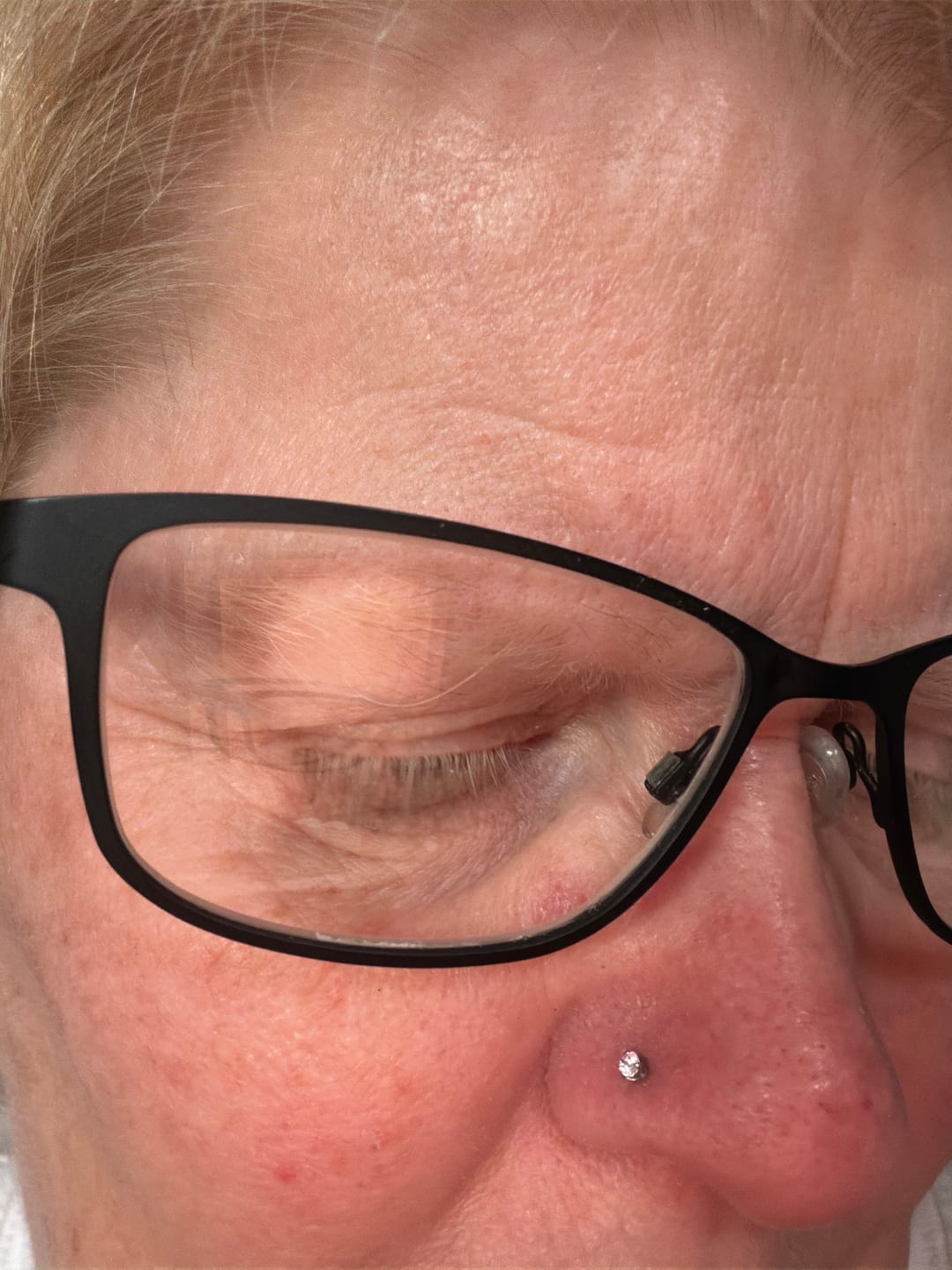 Customer photo review of Junipurr Titanium Flatback Labret Threadless
